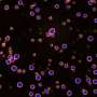 Caracteristica celulara implicata in cancer se formeaza diferit decat se credea anterior