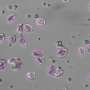 Moartea celulara programata in microalge seamna cu cea la oameni