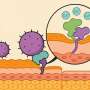 Prinderea de moarte Cum bacteriile stafilococ captze pielea umana