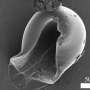 Spargerea cochiliei nanoculturii pentru a descoperi noi frontiere in cercetarea microbiomului