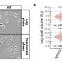 proteine mici ignorat e in e coli ofera informatii noi despre bacterii