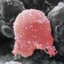 Terapia cellulara Nanopack vizeaza inflamatia in sclerosis multipla
