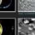 Chirurgia de cataractă va fi necesară în spațiu, prezice un chirurg